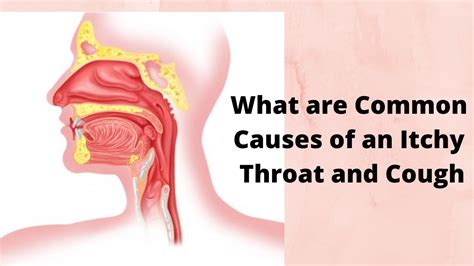 What are Common Causes of an Itchy Throat and Cough - YouTube