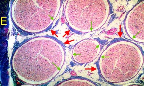 Peripheral Nerve Histology Cross Section