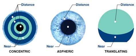 Varifocal Contact Lenses | Multifocal Contacts - Eyesite Opticians