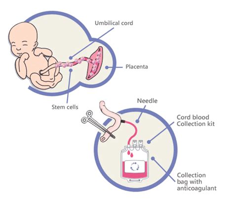 Cord blood bank - 1 Reason to get the best - Genecell