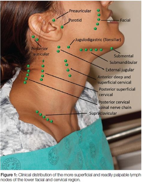 Lower facial and cervical lymphadenopathy in the context of clinical ...