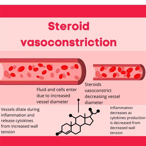 Topical Steroid Withdrawal Syndrome: A Retrospective Chart Review in a ...