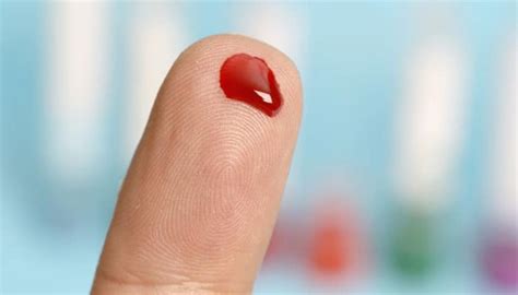 New gel to stop wounds from bleeding | Health News | Zee News