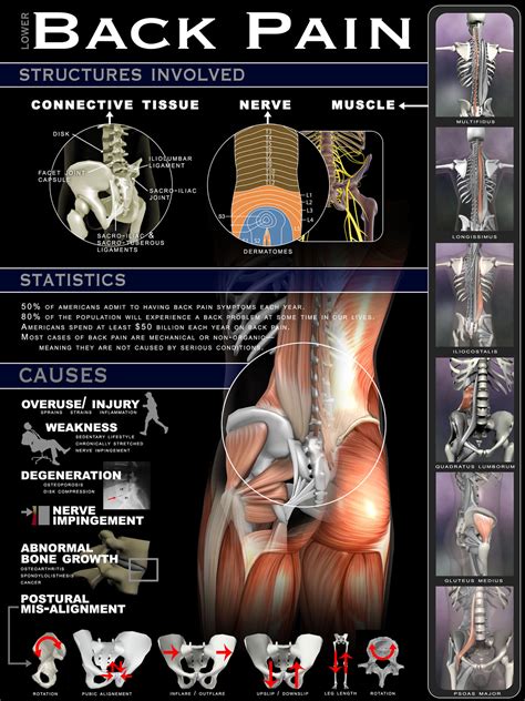 Mri and lower back pain Archives | Joachim's Training