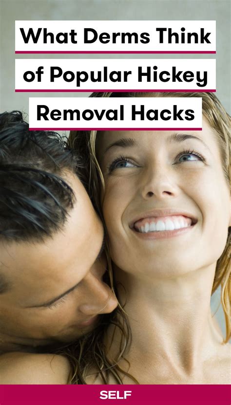 9 of the Most Popular Hickey Removal Hacks—and What Dermatologists ...