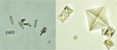 Different morphologies of crystals made of calcium oxalate dihydrate ...