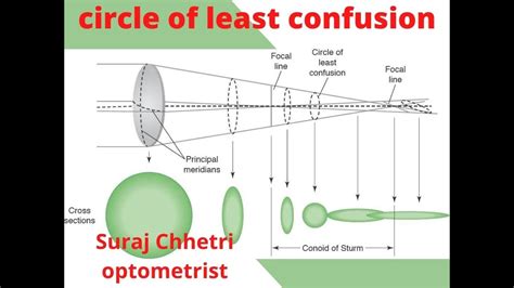 CIRCLE OF LEAST CONFUSION CLINICAL ORIENTATION BY SURAJ CHHETRI - YouTube