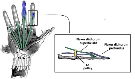 The Flexor Pulley System of the Hand - Annular - Cruciate - Oblique ...