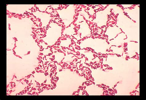 Public Domain Picture | Bacillus coagulans. Gram stain. | ID ...