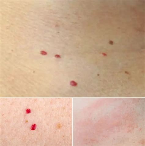 Red dots on your skin: Causes and what they could mean – Kennzo World