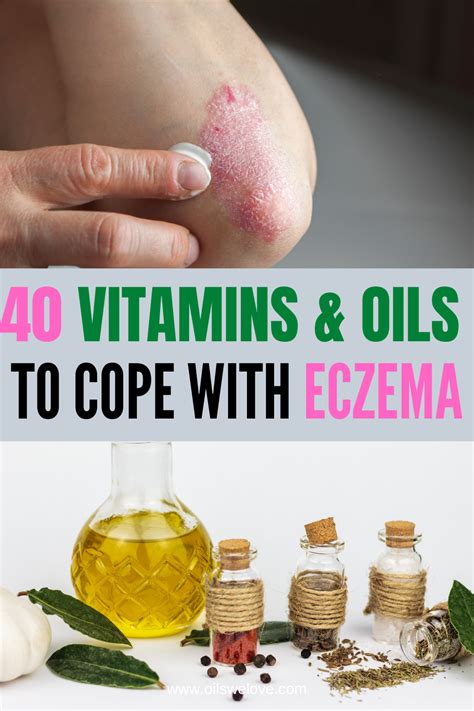 40 Natural Eczema Treatments & Remedies in 2021 | Home remedies for ...