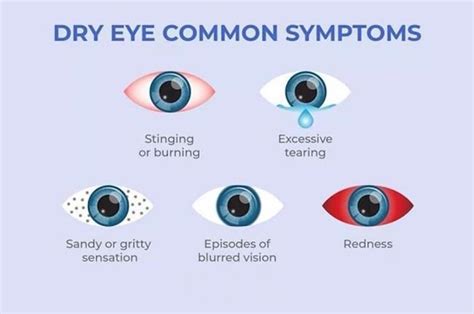 Eye Drops For Dry Eyes | Advanced Eye Clinic