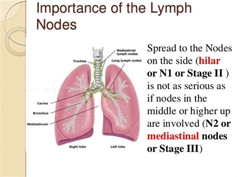 Hilar Lymph Nodes Lung Cancer