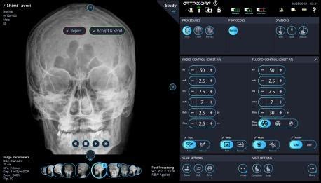 A unique imaging platform for dynamic X-ray applications • healthcare ...