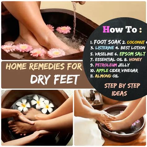 #11 Smooth & Soft Feet: How to Get Rid of Dry Feet - Home Remedies