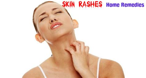 Skin Rashes Home Remedies & Treatment for Skin Allergy - Stylish Walks