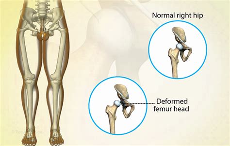 Health Condition : Symptoms, Causes, Treatment and More