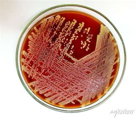 Staph aureus: gram positive bacteria. staphylococcus or streptococcus ...