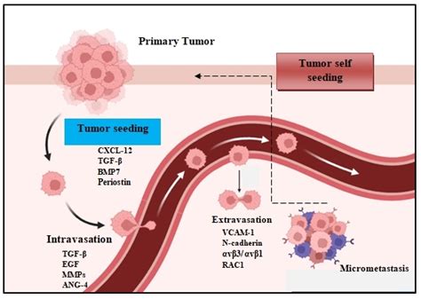 Extravasation Cancer