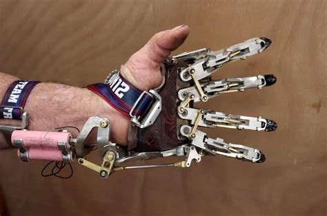 Engineer designed and built his own functioning mechanical prosthetic ...