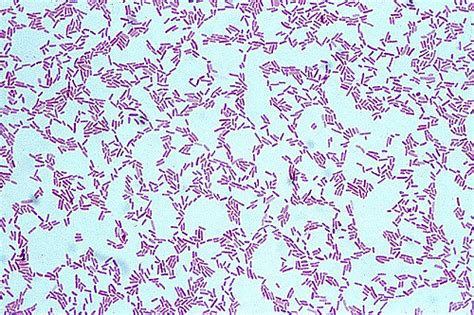 Pseudomonas Aeruginosa Gram Stain