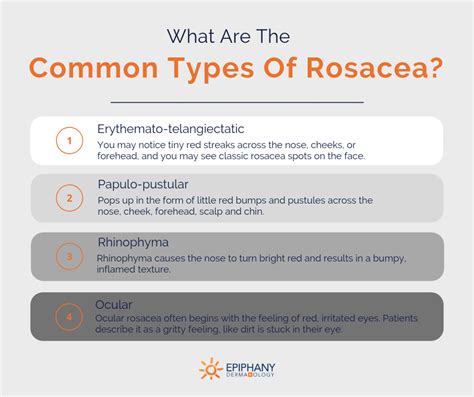 The Complete Guide to Rosacea Treatment | Epiphany Dermatology