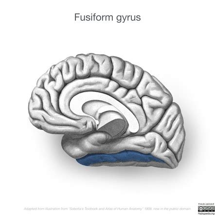 Fusiform gyrus | Radiology Reference Article | Radiopaedia.org