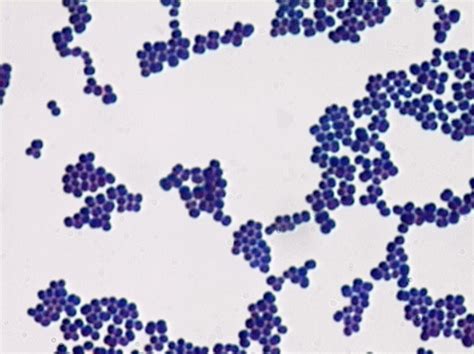 Gram Stain results