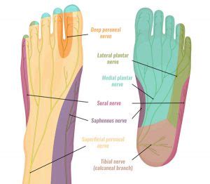 Medial Calcaneal Nerve Entrapment - Symptoms & Treatment