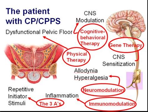 Chronic Pelvic Pain Syndrome. Causes, symptoms, treatment Chronic ...