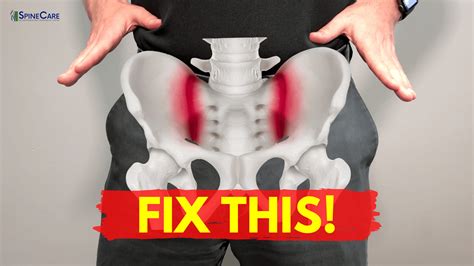 How to Fix Sacroiliac Joint Pain for Good | SpineCare | St. Joseph, MI