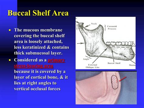 PPT - Anatomy of Mandibular Denture Bearing Area PowerPoint ...