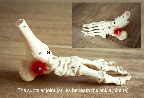 Subtalar Joint Fusion Surgery | David Redfern Orthopaedic Surgery