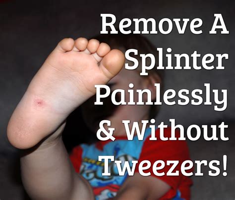 Remove A Splinter Without Tweezers! - It Keeps Getting Better