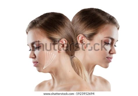 Woman Double Chin Before After Stock Photo (Edit Now) 1923952694