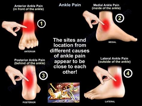 Anterior Ankle Pain (Front) Symptoms, Causes Treatment | eduaspirant.com