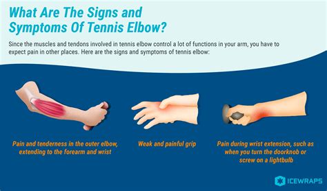 How To Cure Elbow Pain - Shopfear0