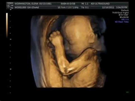 30 weeks pregnant 4d ultrasound - sekamaine