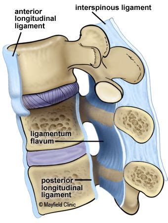 Figure 7 The ligamentum flavum, anterior longitudinal ligament and ...