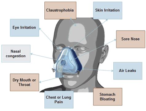 Managing CPAP Side Effects | CPAP Maintenance | Irish CPAP Experts