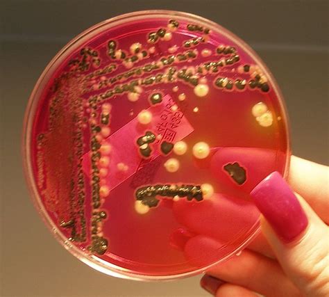 Salmonellae growing on XLD Agar | Medical Laboratories