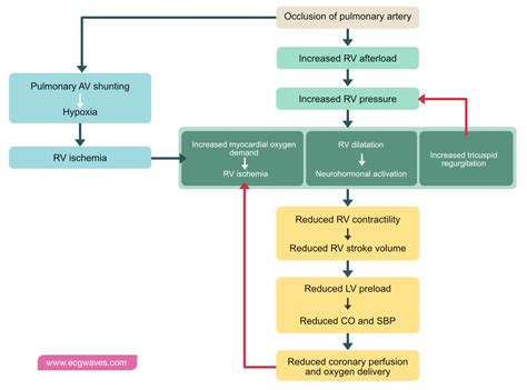 Pulmonary Embolism (PE): Causes, symptoms, diagnosis, treatment