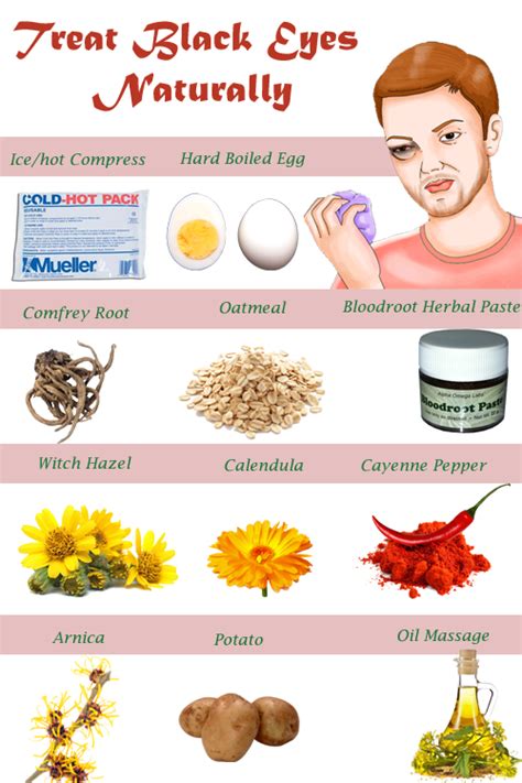 Home Remedies for Black Eyes Treatment | Black eye remedies, Eye black ...