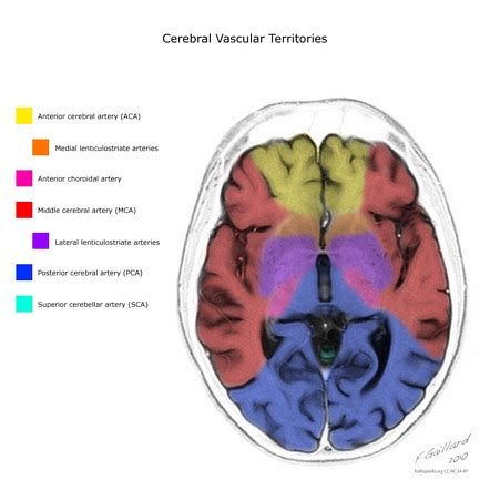 mca supplies what part of brain - finelineartdrawingsshape