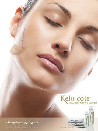 Keloid Removal Cream – Best for Keloid Scar, Ear Keloid Removal Cream