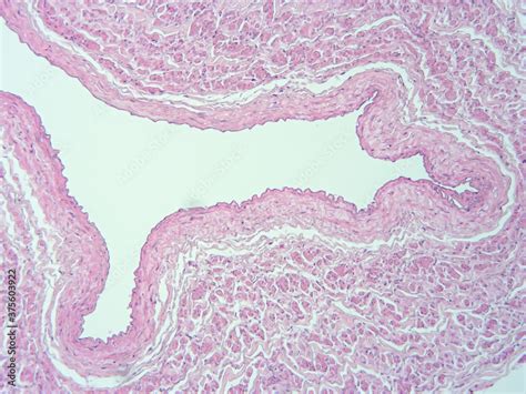 picture of histology human tissue with microscope from laboratory (not ...