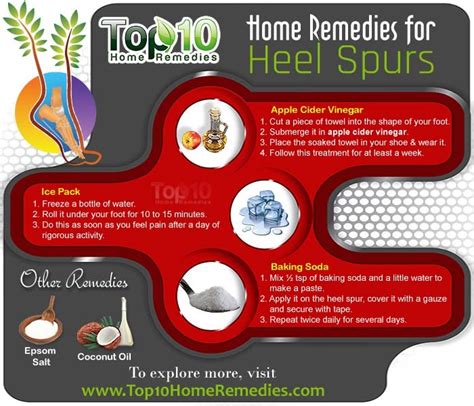 Home Remedies for Heel Spurs | Top 10 Home Remedies