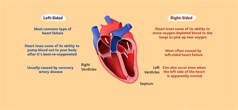 Left Sided Heart Failure, Causes, Symptoms and Treatment | Dr. Raghu