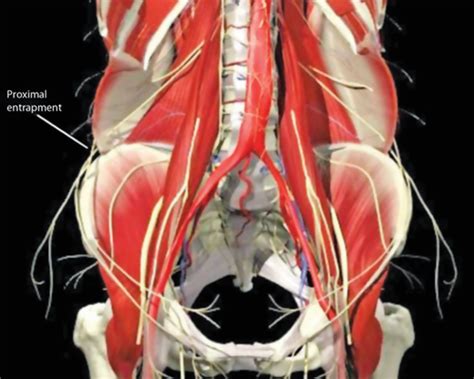 Ilioinguinal and Iliohypogastric Nerve Blocks | Atlas of Pain Medicine ...