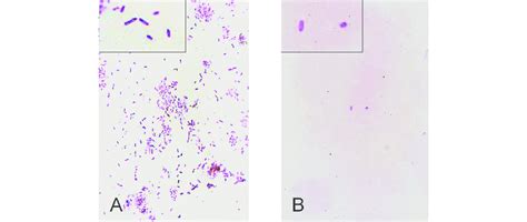 Pseudomonas Aeruginosa Gram Stain